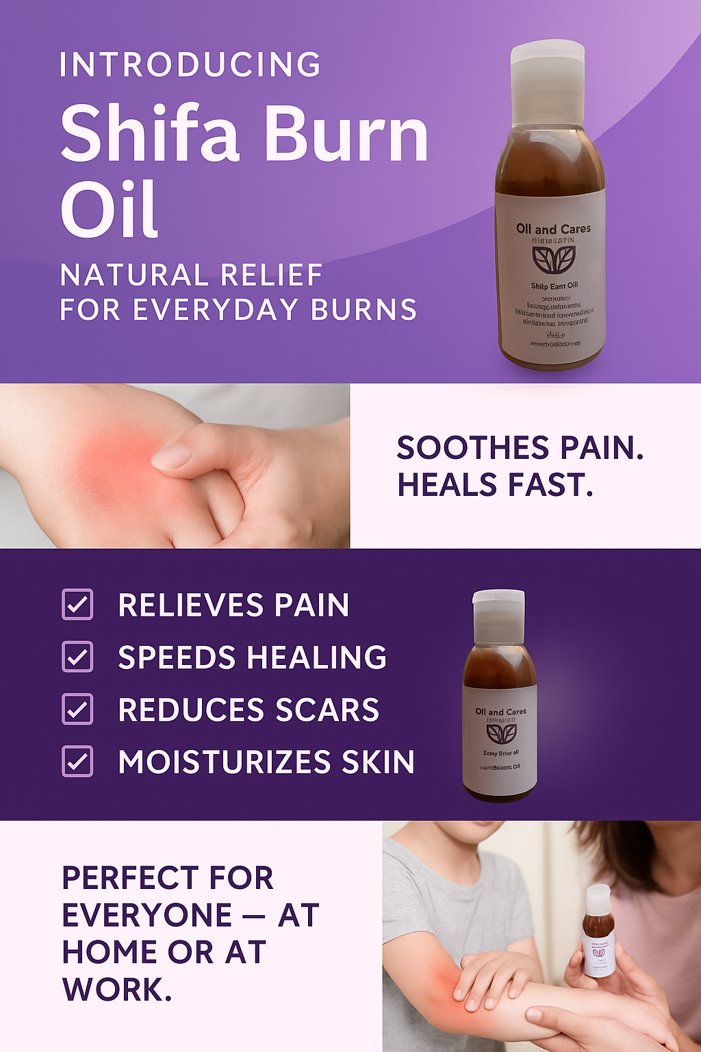 Shifa Burn Oil – 100% Natural Anti-Burn Formula with Mustard Oil