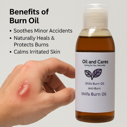 Shifa Burn Oil – 100% Natural Anti-Burn Formula with Mustard Oil