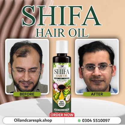 Shifa Hair Oil – 100% Herbal & Natural Hair Growth Oil
